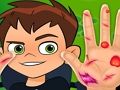 Cluiche Dochtúir Láimhe Ben10  ar líne