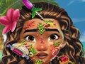 Cluiche Dochtúir Craiceann Moana  ar líne