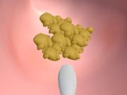 Cluiche Clinic Earwax  ar líne