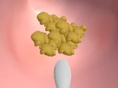 Cluiche Earwax Clinic ar líne