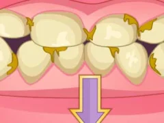 Cluiche Bad Teeth Makeover ar líne