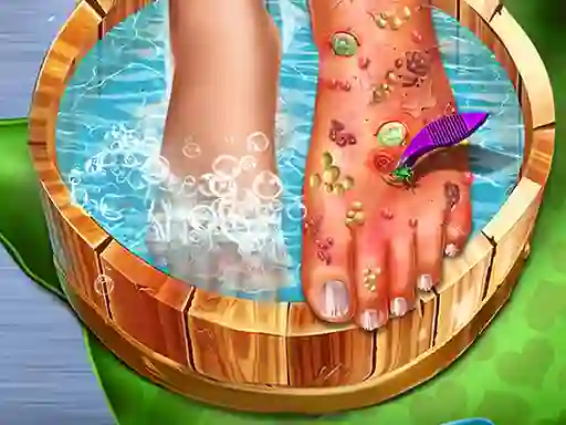Cluiche Feet Skin Doctor ar líne