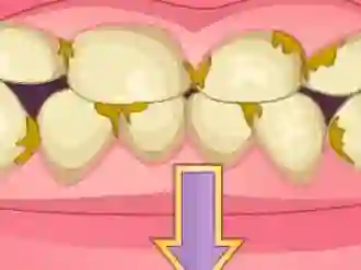 Cluiche Bad Teeth Makeover ar líne