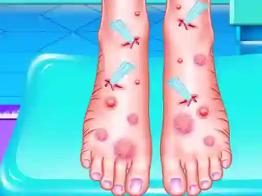 Cluiche Emma Foot Treatment ar líne