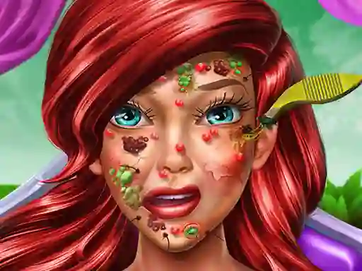 Cluiche Princess Mermaid Skin Doctor ar líne