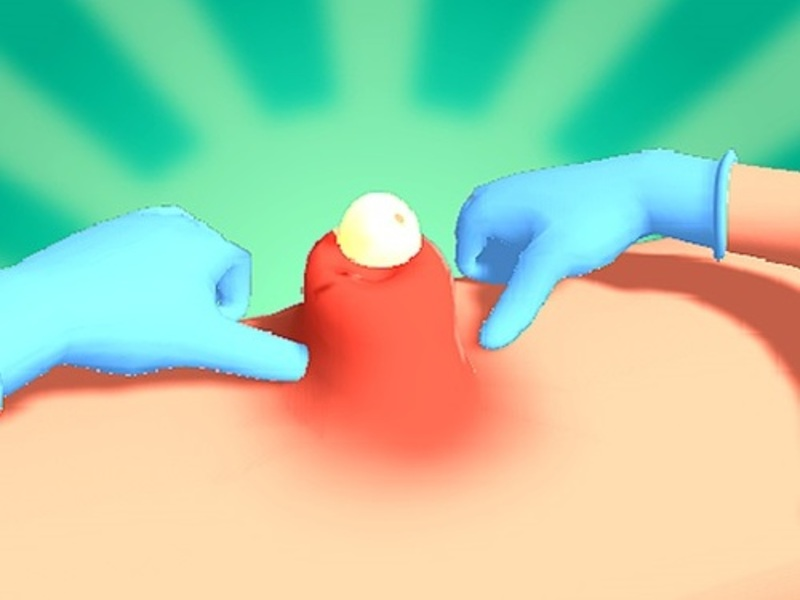 Cluiche Pimple Squeeze ar líne